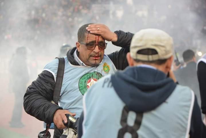 Maroc : Violents affrontements après le match entre le Raja et l’AS FAR 