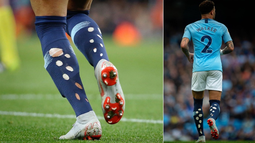 Football : savez-vous pourquoi les joueurs trouent leurs chaussettes ?
